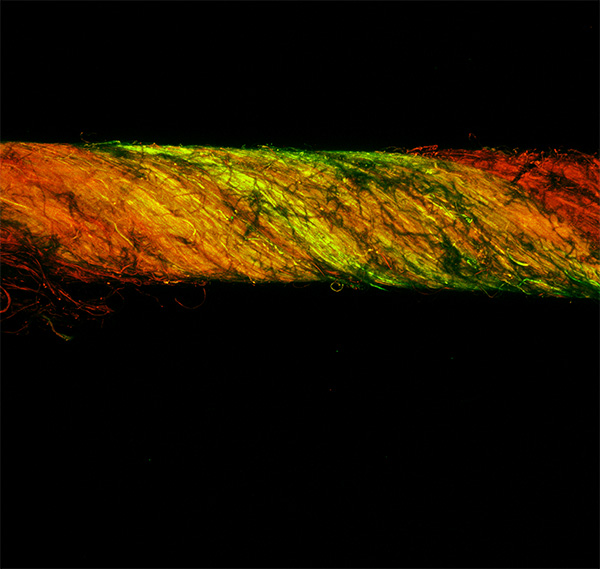 Entitled “Fluorescent Coalescent,” Keblawi’s image of nanofiber yarn was captured using a confocal microscope in the lab of Vince Beachley, Ph.D. 
