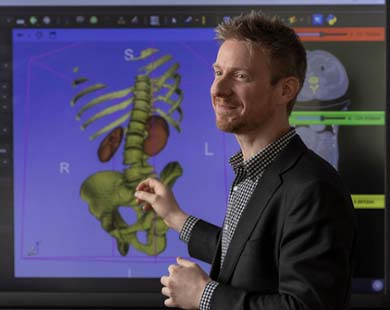 Erik Brewer is collaborating with Virtua's Nasser Youssef, MD, to understand how CT scans correlate with organ transplant outcomes.
